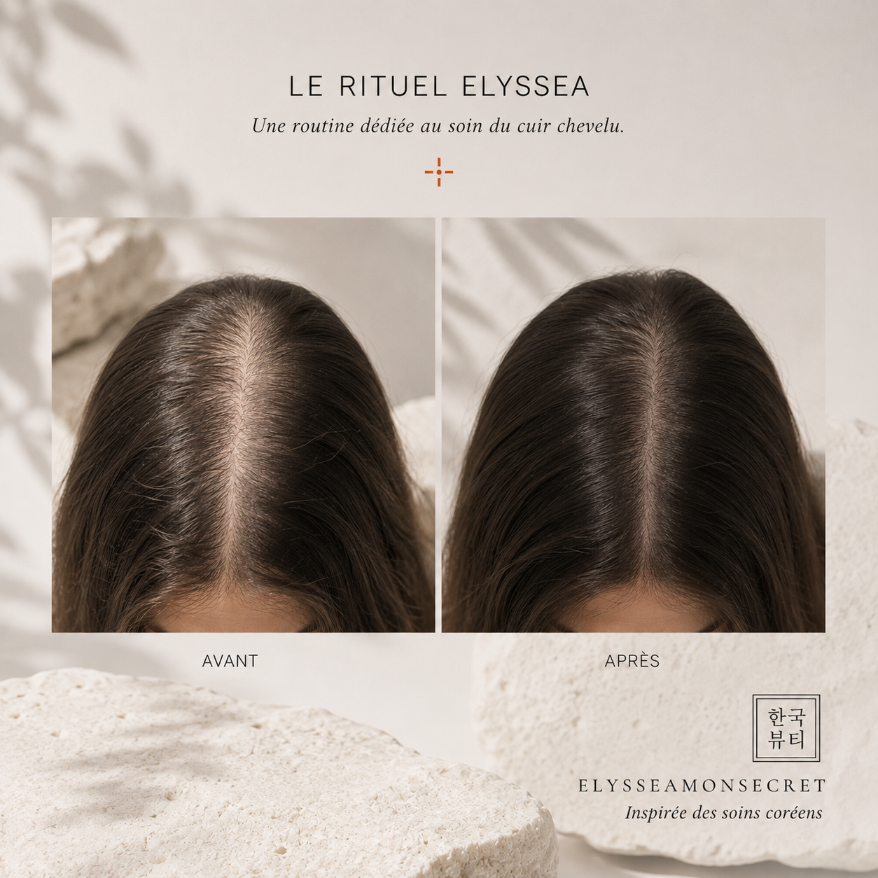 Sérum Cuir Chevelu au Heartleaf
