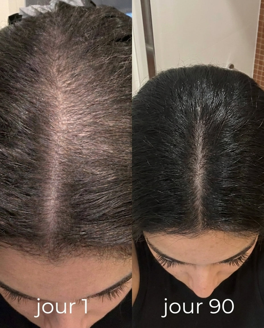 Favorisez visiblement la pousse de cheveux en 30 jours - Gummies Elyssea